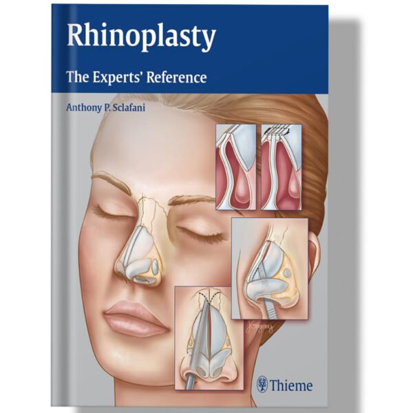 Rhinoplasty: The Experts' Reference 1st Edition