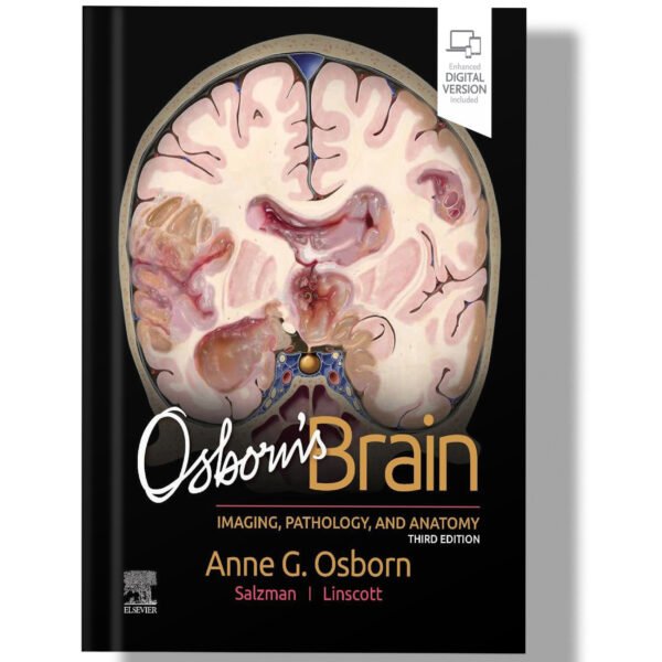 Osborn's Brain 3rd Edition
