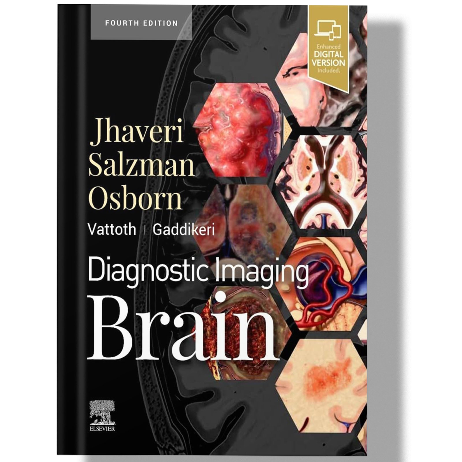 Diagnostic Imaging: Brain 4th Edition