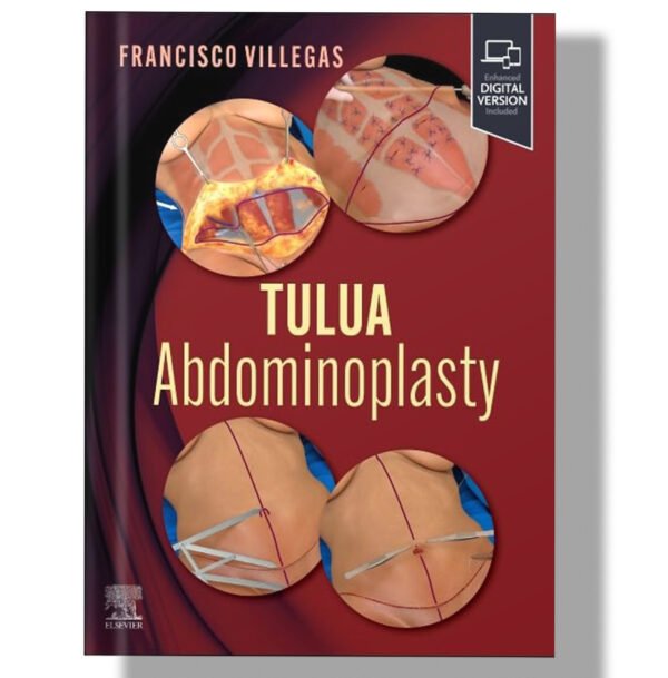 TULUA Abdominoplasty: Transverse Plication Technique 1st Edition