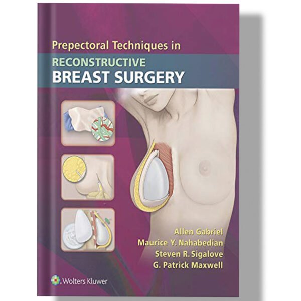 Prepectoral Techniques in Reconstructive Breast Surgery 1st Edition