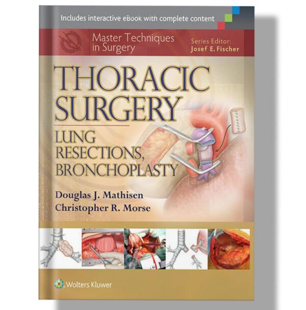 Thoracic Surgery: Lung Resections, Bronchoplasty (Master Techniques in Surgery) 1st Edition