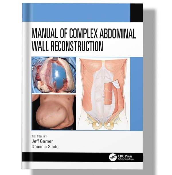 Manual of Complex Abdominal Wall Reconstruction 1st Edition