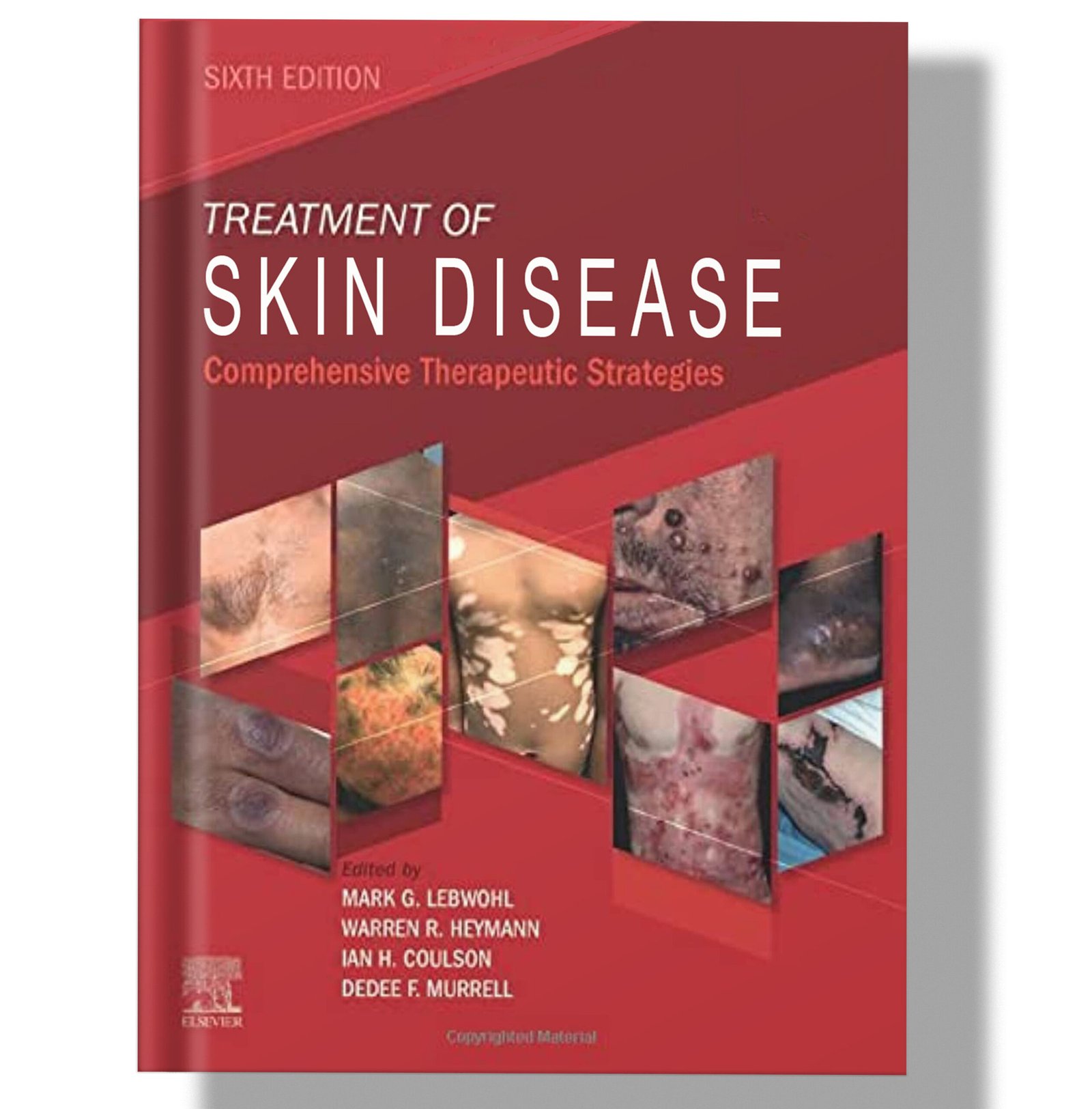 Treatment of Skin Disease: Comprehensive Therapeutic Strategies 6th Edition