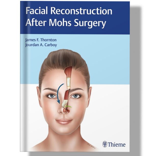 Facial Reconstruction After Mohs Surgery 1st Edition