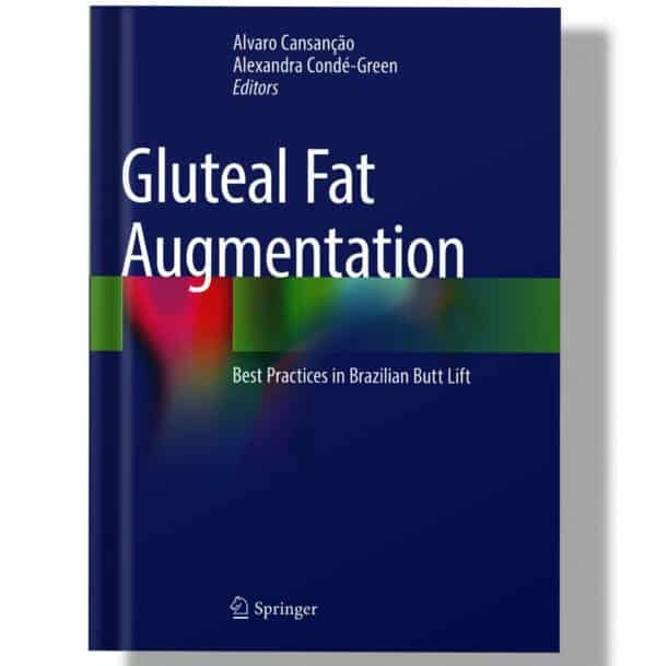Gluteal Fat Augmentation: Best Practices in Brazilian Butt Lift 1st Edition