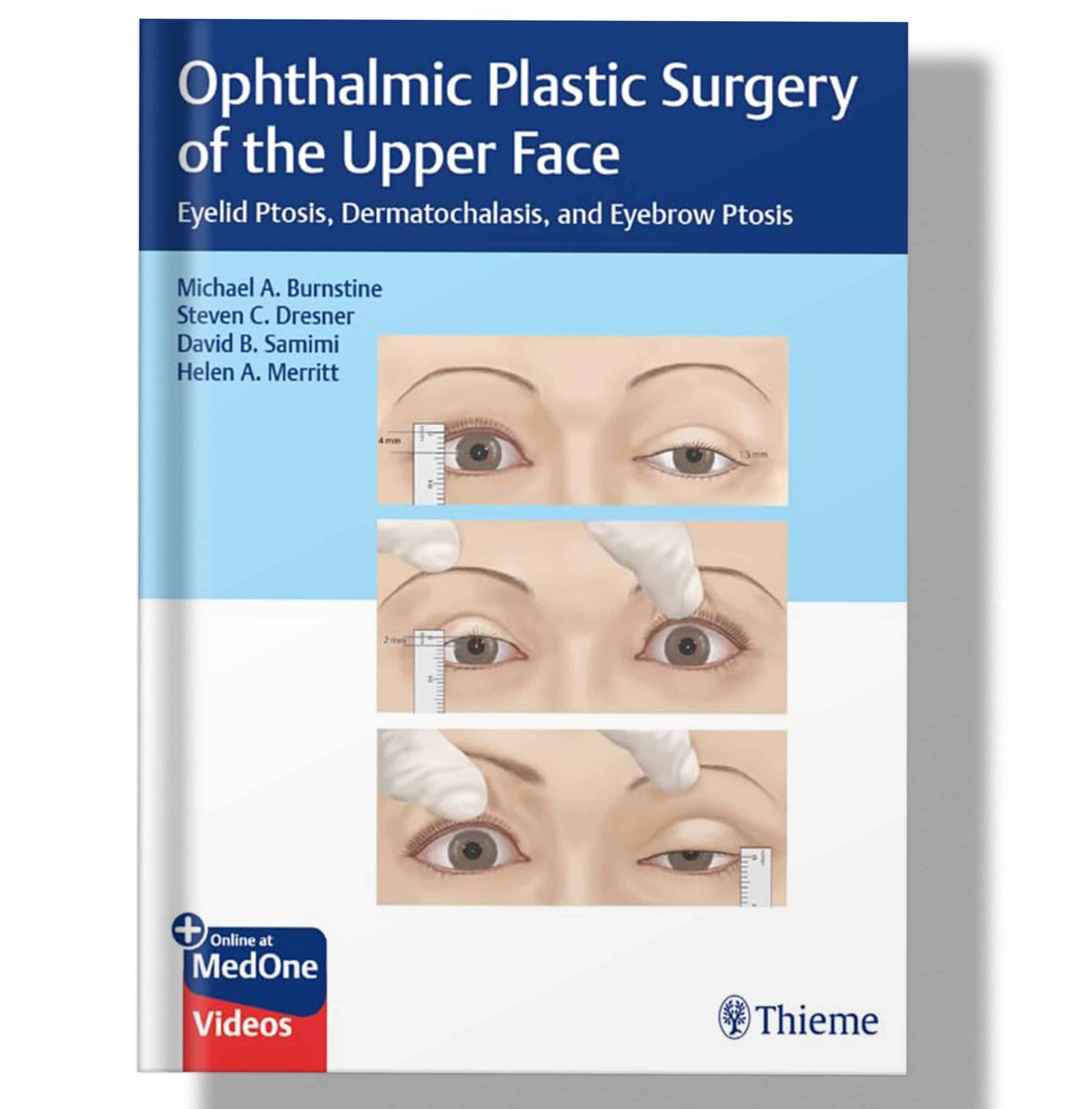 Ophthalmic Plastic Surgery of the Upper Face: Eyelid Ptosis, Dermatochalasis, and Eyebrow Ptosis