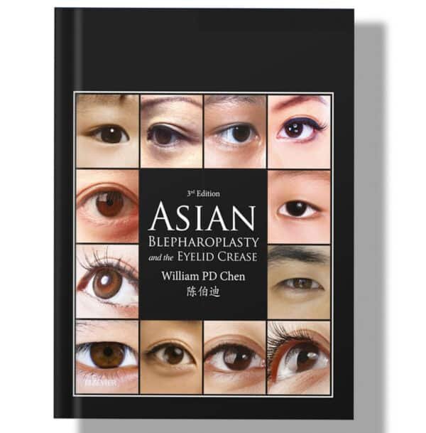 Asian Blepharoplasty and the Eyelid Crease 3rd Edition