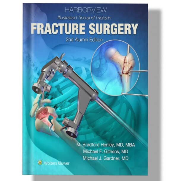 Harborview Illustrated Tips and Tricks in Fracture Surgery 2nd Edition