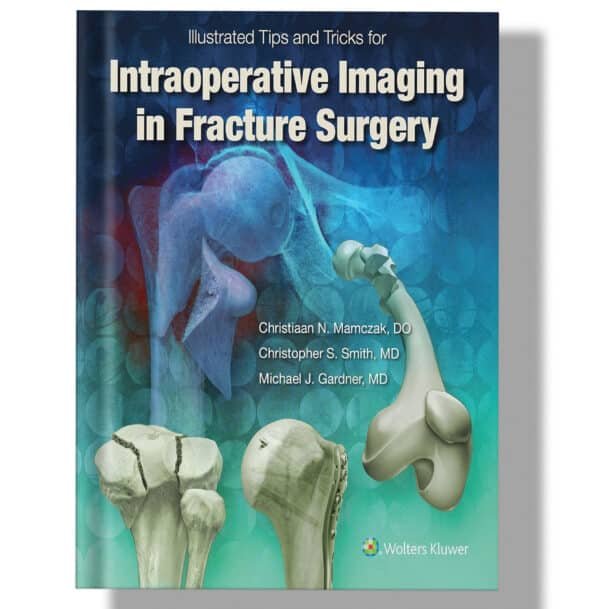 Illustrated Tips and Tricks for Intraoperative Imaging in Fracture Surgery First Edition
