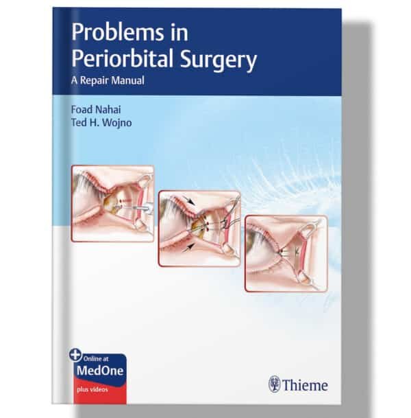 Problems in Periorbital Surgery: A Repair Manual 1st Edition