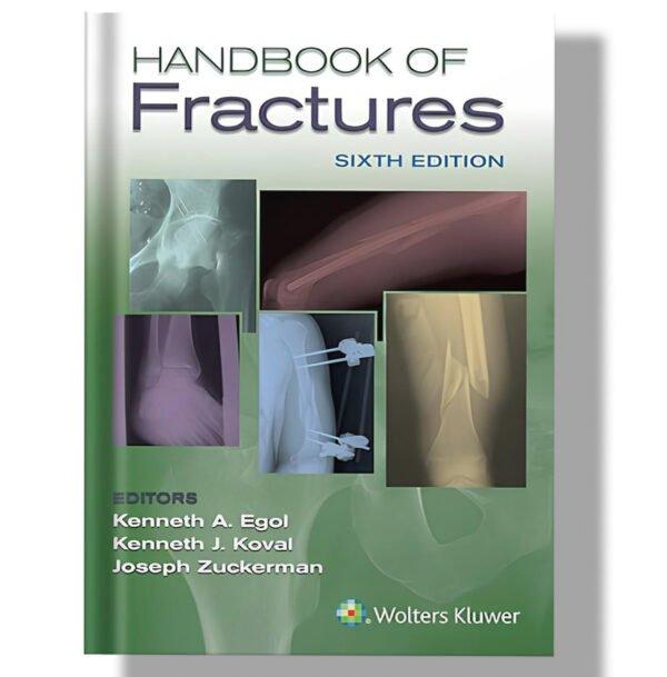 Handbook of Fractures 6th Edition