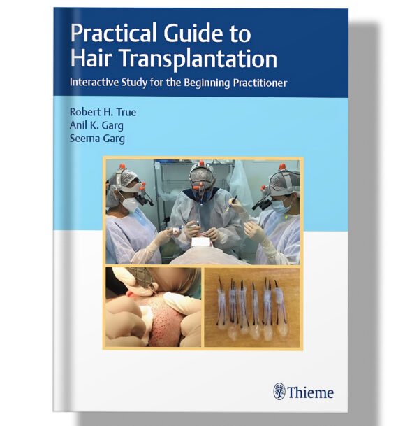 Practical Guide to Hair Transplantation: Interactive Study for the Beginning Practitioner