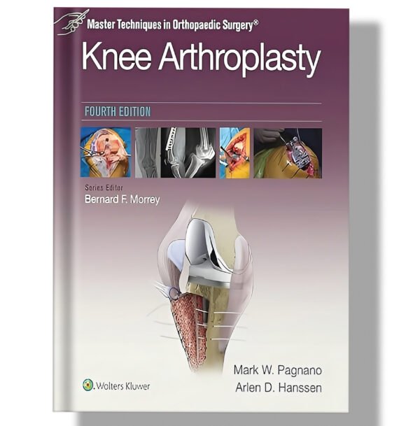 Master Techniques in Orthopedic Surgery: Knee Arthroplasty 4th Edition