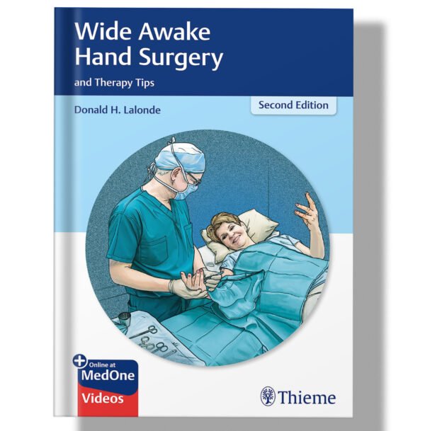 Wide Awake Hand Surgery and Therapy Tips 2nd Edition