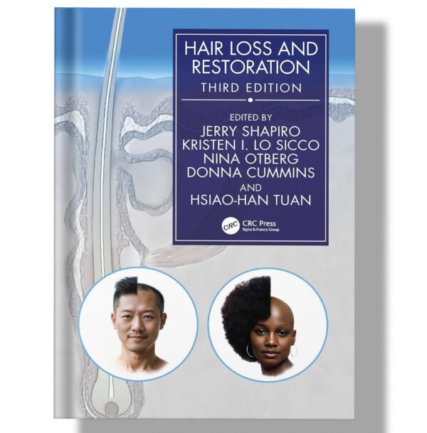 Hair Loss and Restoration 3rd Edition