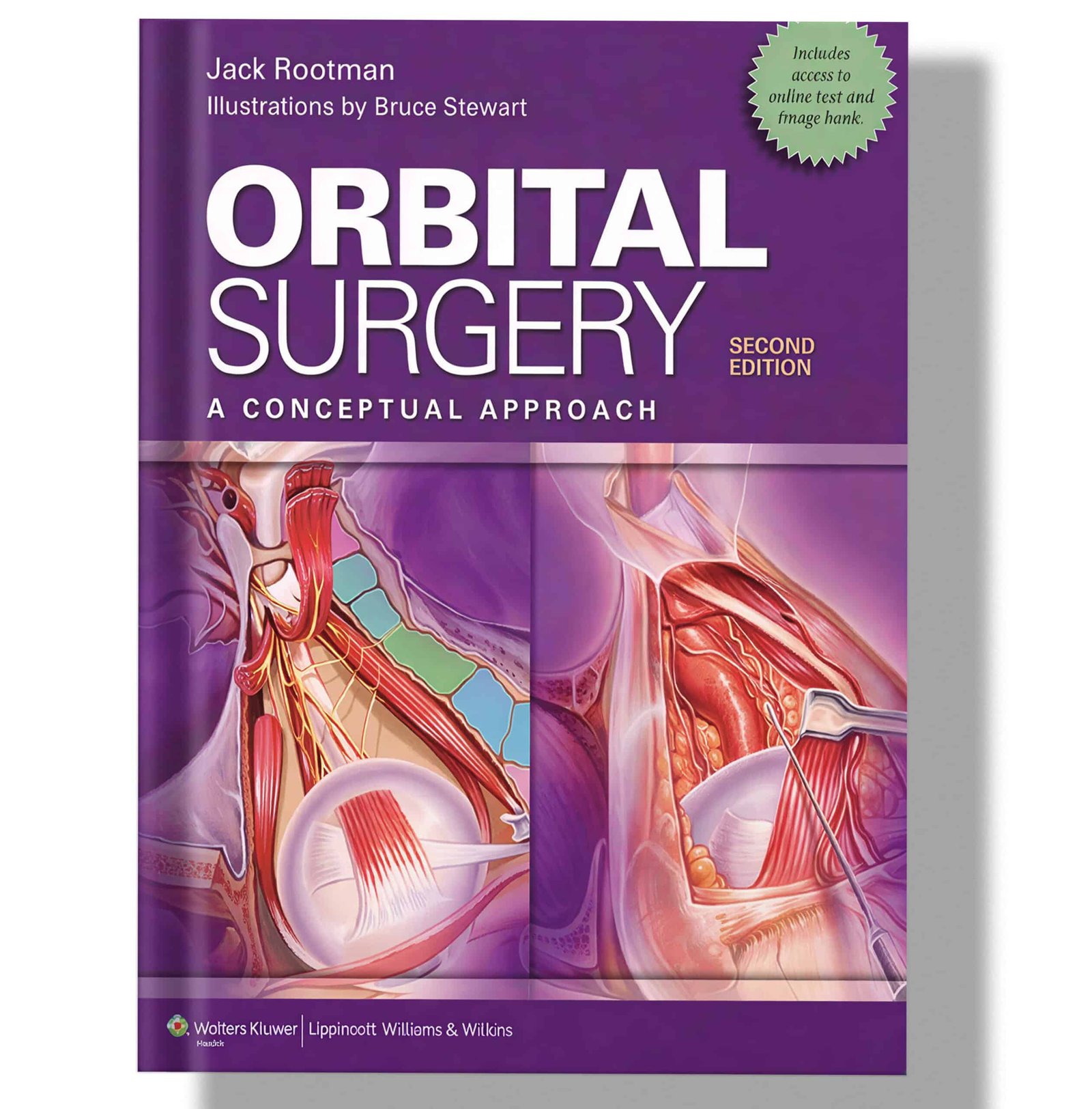Orbital Surgery: A Conceptual Approach 2nd Edition