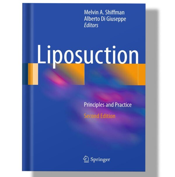 Liposuction: Principles and Practice 2nd Edition