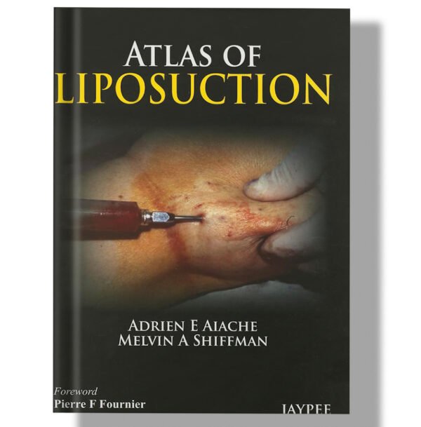 Atlas of Liposuction 1st Edition