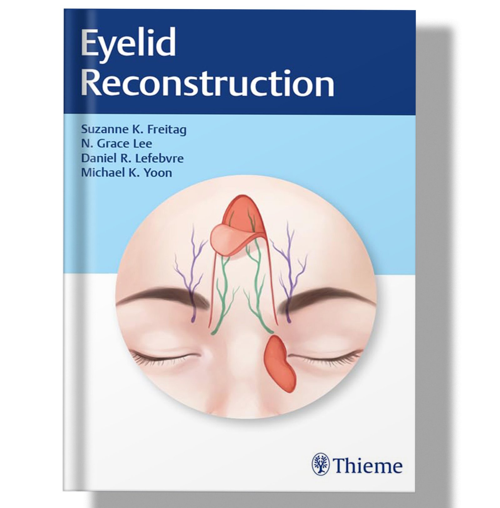 Eyelid Reconstruction 1st Edition